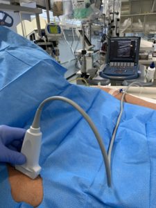 Reducing bloodstream infections in an intensive care unit, Republic of Cyprus